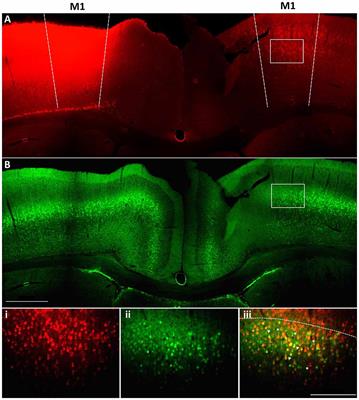 Transcriptome Profiling of Layer 5 Intratelencephalic Projection Neurons From the Mature Mouse Motor Cortex